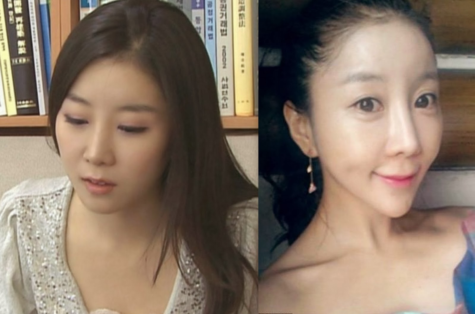 Manny360: Facial Surgery Gone Wrong - Pretty TV Presenter Who Deformed