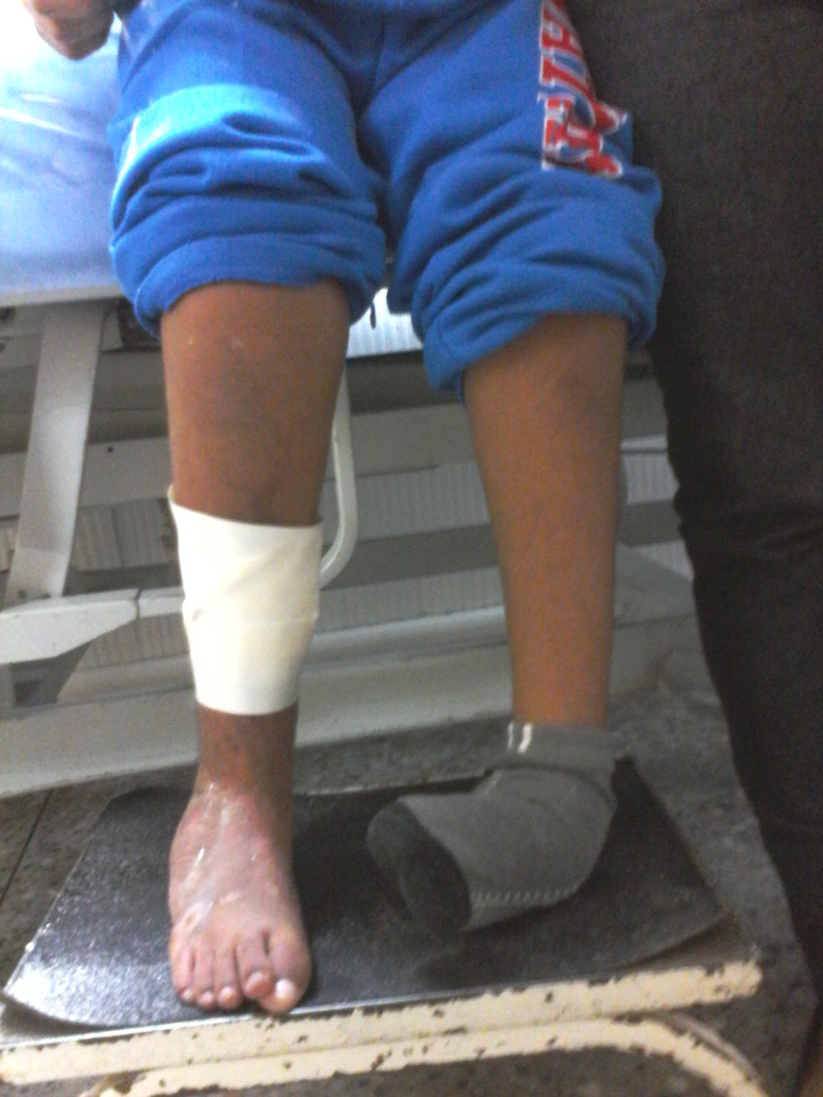 CIRUGIA ORTOPEDICA RECONSTRUCTIVA DE MIEMBROS INFERIORES * * * * C. O