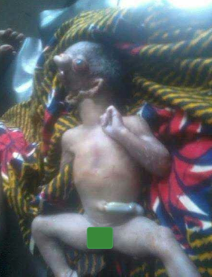 baby without face aba abia