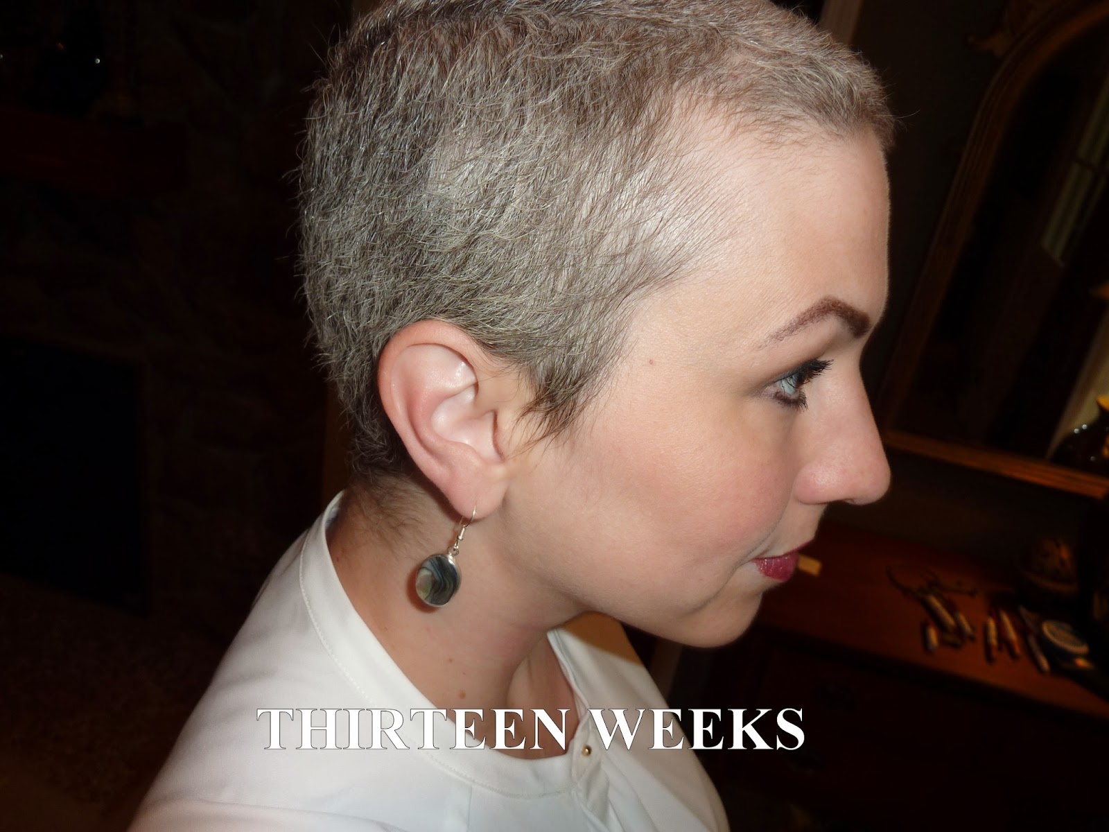 Anncredible: Hair Growth Progression after Chemo- Six Months with UPDATE!