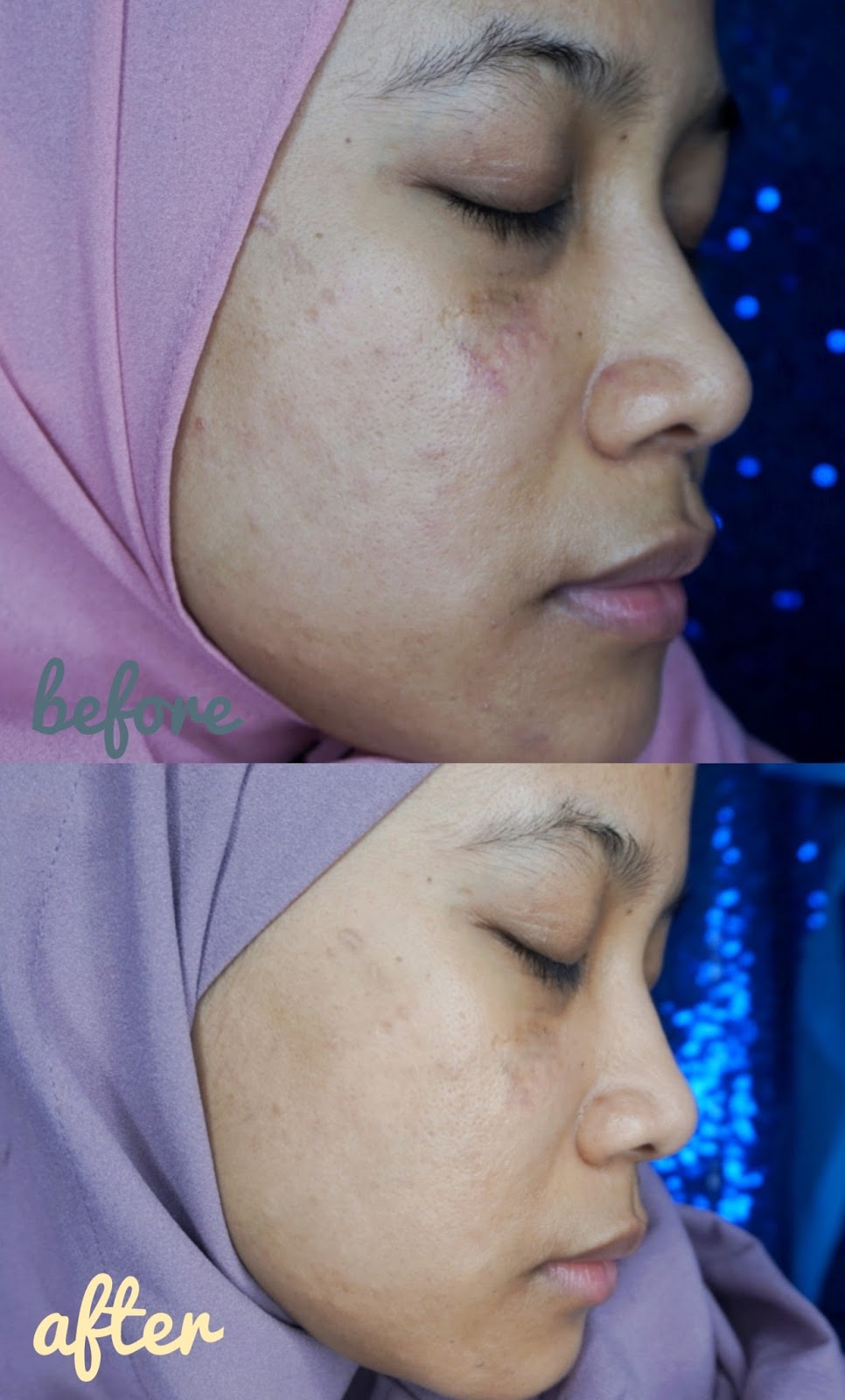 review pixy skincare