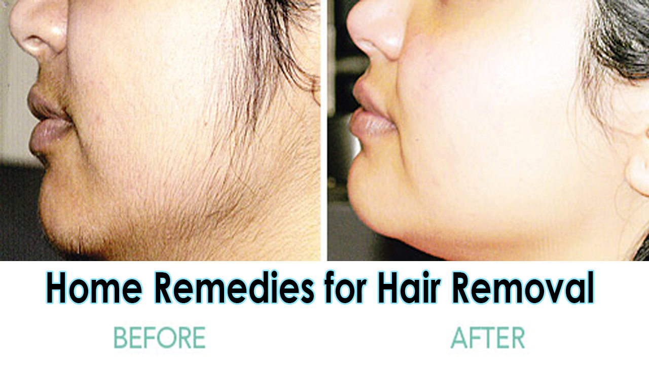 Home Remedies For Hair Removal 7 Natural Remedies For Hair