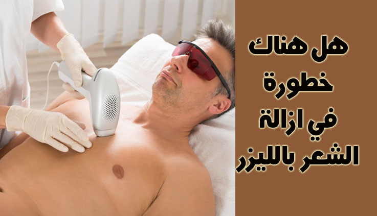 اسعار ازالة الشعر بالليزر