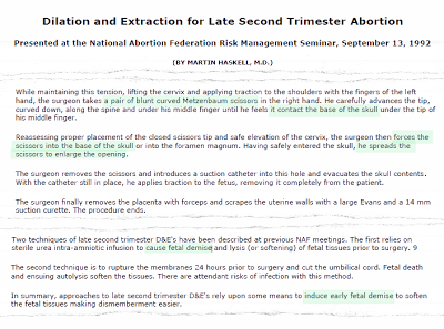 Highlighted copy of Martin Haskell's D&X presentation paper at the National Abortion Federation. Highlighted sections show how the scissors are to be inserted into the back of the baby's neck, and note the use of the term "fetal demise."