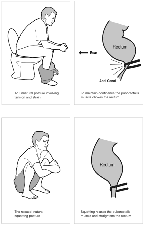 Position sur les toilettes.