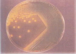 Gambar Bakteri Vibrio cholerae