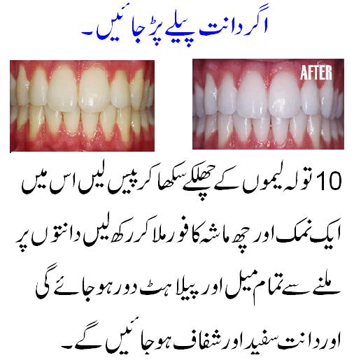 Teeth Tips Urdu eBeauty Magazine