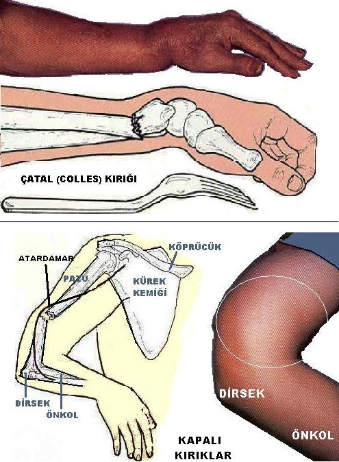 konya kirik cikik eylul 2015