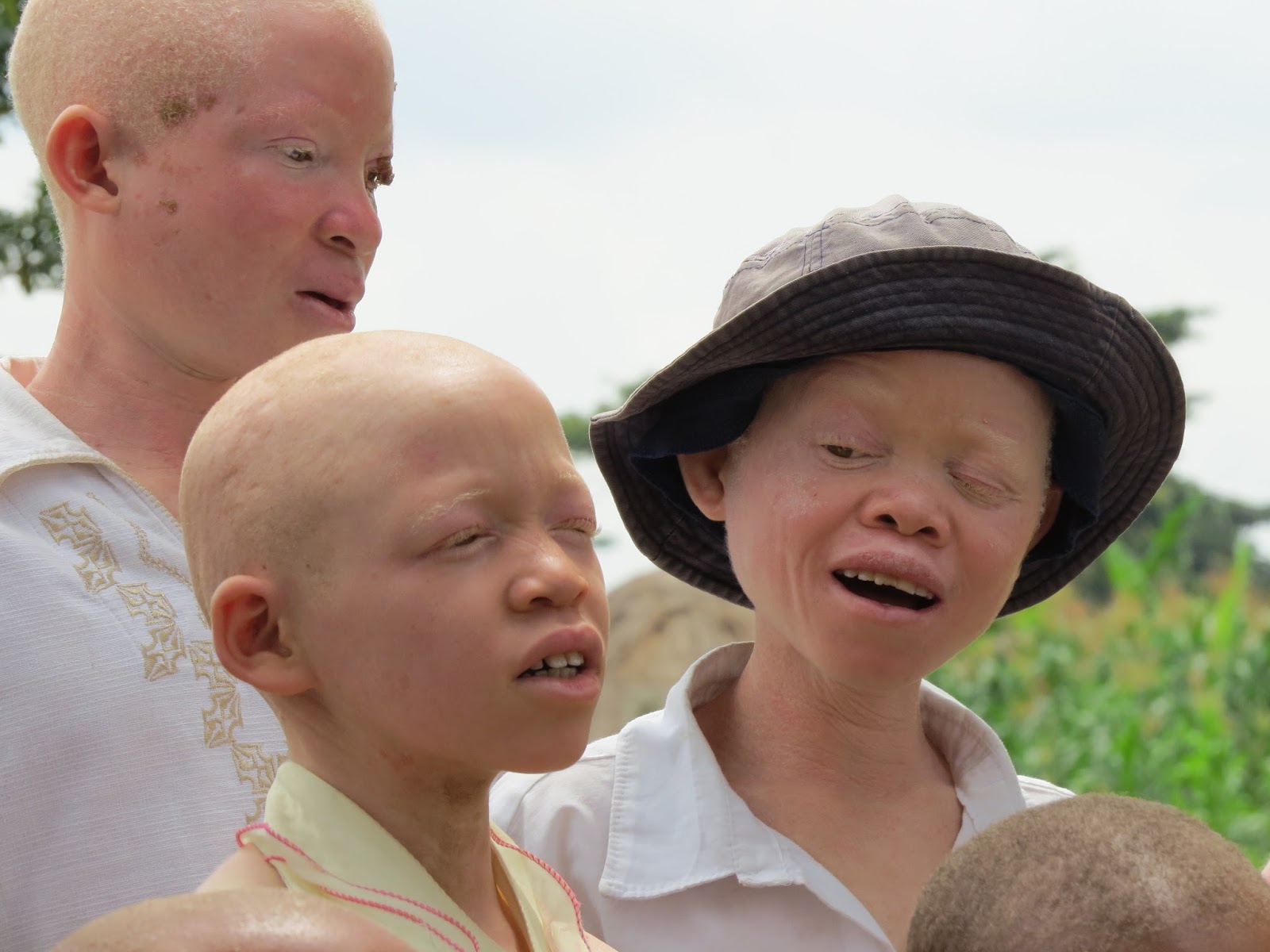 негр и азиат альбинос фото 59