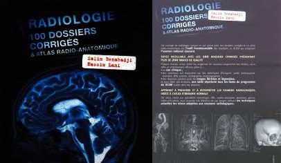 Télécharger Radiologie 100 dossiers corrigés PDF gratuit