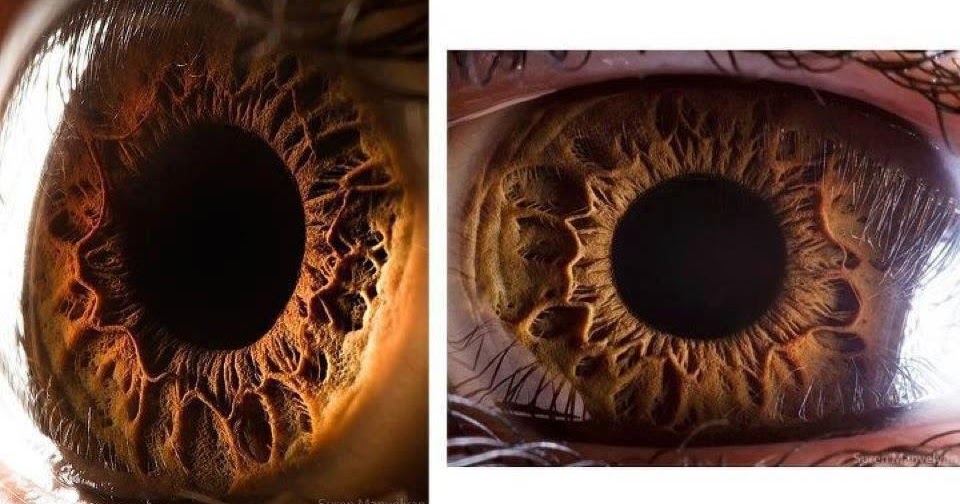 Hangini Alsak?: Gözümüzün yakından görünüşü. Çok gizemli.