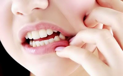 Obat Sakit Gigi Berlubang Paling Ampuh dan Mujarab