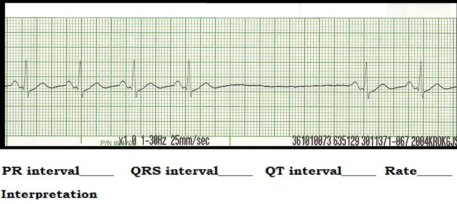 ECG Rhythm Strip Quiz 89 Interval measurements
