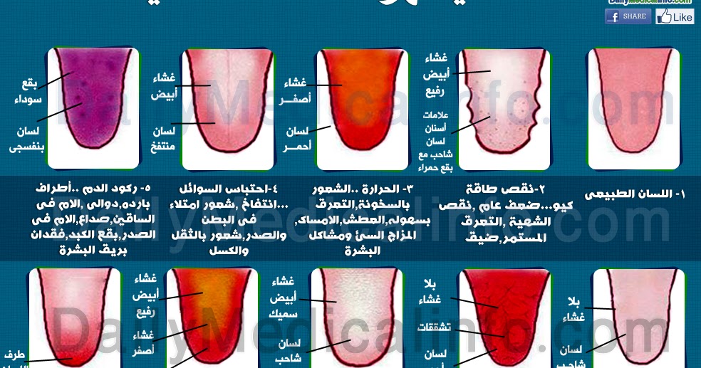 لسانك يظهر حالتك الصحية عرب فايرال