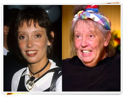 Shelley Duvall (Antes e Depois) Before and After