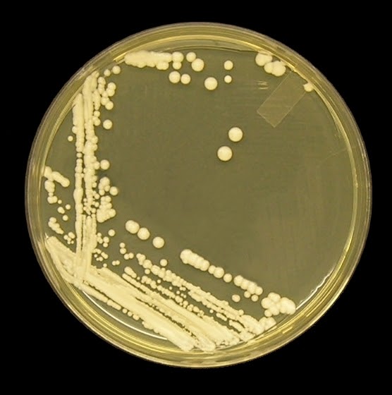 Fun With Microbiology (What's Buggin' You?): Candida albicans