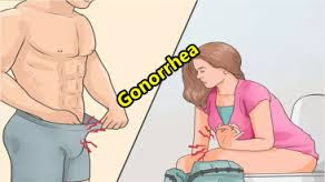 Harga Obat Kencing Nanah Di Apotik Harga Obat Kencing Nanah Di Apotik