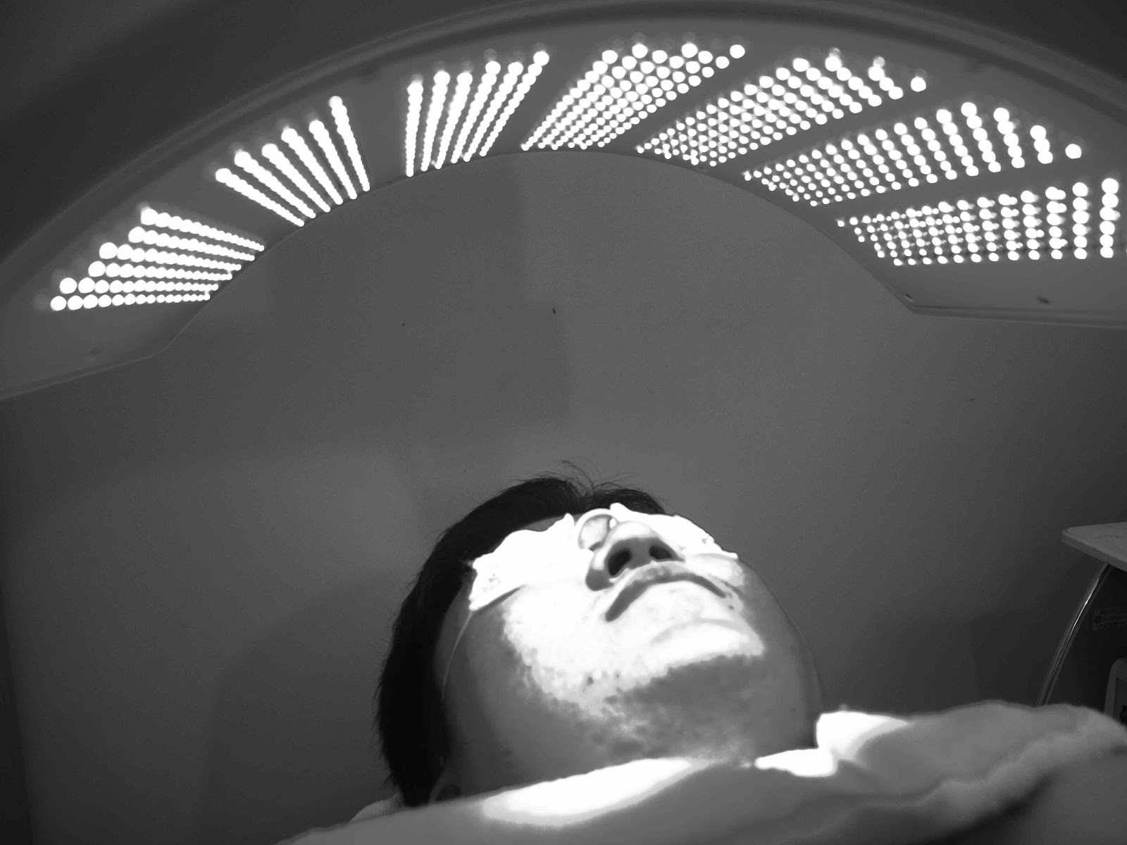 SkinStation Can Light Therapy Clear Acne?