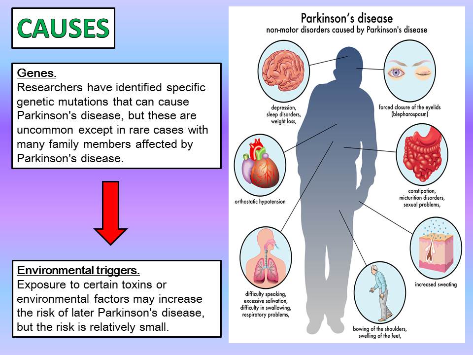 Parkinson's Disease Diagram