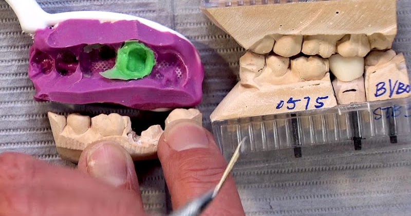 great impression dentist gift great impression dentist gift