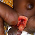 9 month old baby’s penis chopped off