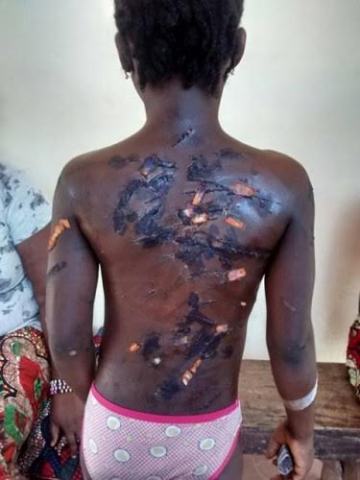 unnamed 9-year-old girl beaten mercilessly for allegedly stealing N500 (photo)