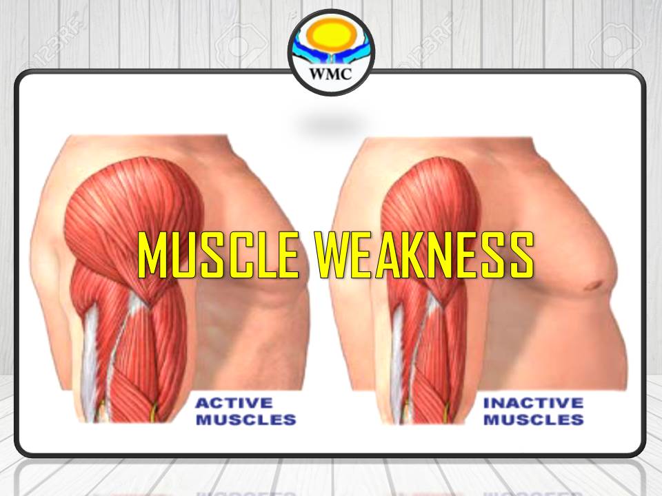 WONG MEDICAL CENTRE IPOH 黄氏医疗中心: MUSCLE WEAKNESS