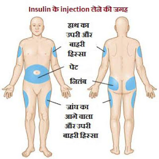 how to give insulin injection in hindi