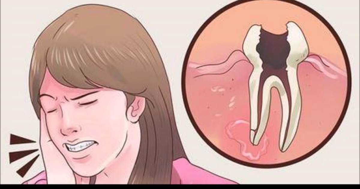 7 Home Remedies For A Toothache That Will Make The Pain Go Away