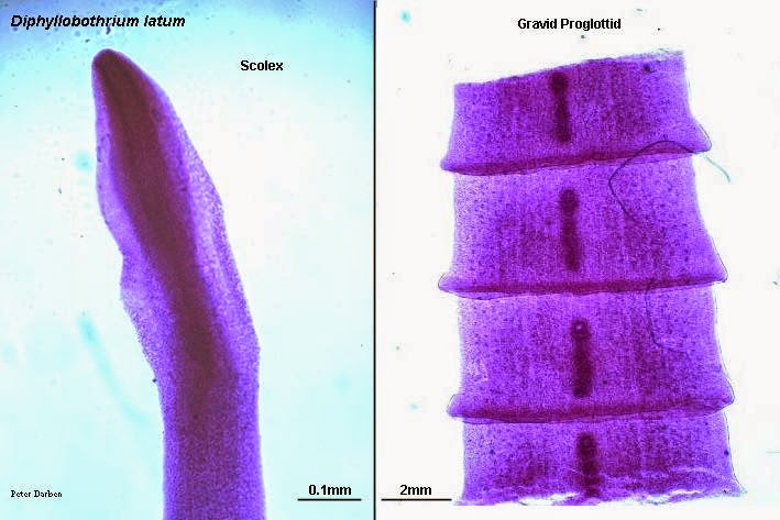 CESTODOS: DIPHYLLOBOTHRIUM LATUM: Generalidades