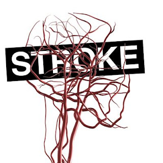 Epidemiologi Penyakit Stroke Hemoragik, Cara Pengobatan Tradisional Stroke Ringan, Asuhan Keperawatan Penyakit Stroke Pada Lansia, Obat Stroke Dan Jantung, Penyakit Stroke Adalah Pdf, Contoh Obat Stroke, Asuhan Keperawatan Penyakit Stroke Non Hemoragik, Obat Stroke Yg Ampuh, Obat Tradisional Penyakit Stroke Berat, Cara Menyembuhkan Penyakit Stroke Dengan Cepat, Obat Stroke Di Surabaya, Pengobatan Stroke Bekasi, Obat Tradisional Stroke 2010, Obat Stroke Lansia, Pengobatan Utk Stroke, Fenomena Penyakit Stroke, Obat Stroke Medis, Obat Gejala Stroke, Cara Menyembuhkan Penyakit Stroke, Mengobati Stroke Secara Tradisional, Doa Menyembuhkan Penyakit Stroke, Usia Penyakit Stroke, Penyakit Stroke Batang Otak, Obat Tradisional Buat Stroke, Mengobati Stroke Berat, Artikel Tentang Penyakit Stroke Pdf, Obat Batuk Untuk Orang Stroke, Obat Herbal Penyakit Stroke, Obat Stroke Alternatif, Obat Tradisional Utk Penyakit Stroke  