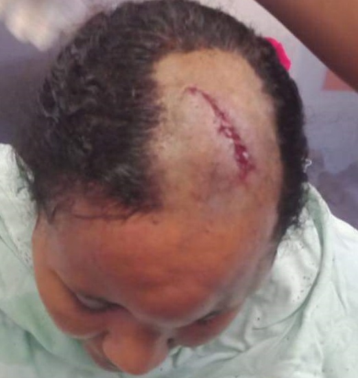 "This is the man who has sworn to kill my younger sister" - Kenyan man calls out brother-in-law over physical abuse of his sister