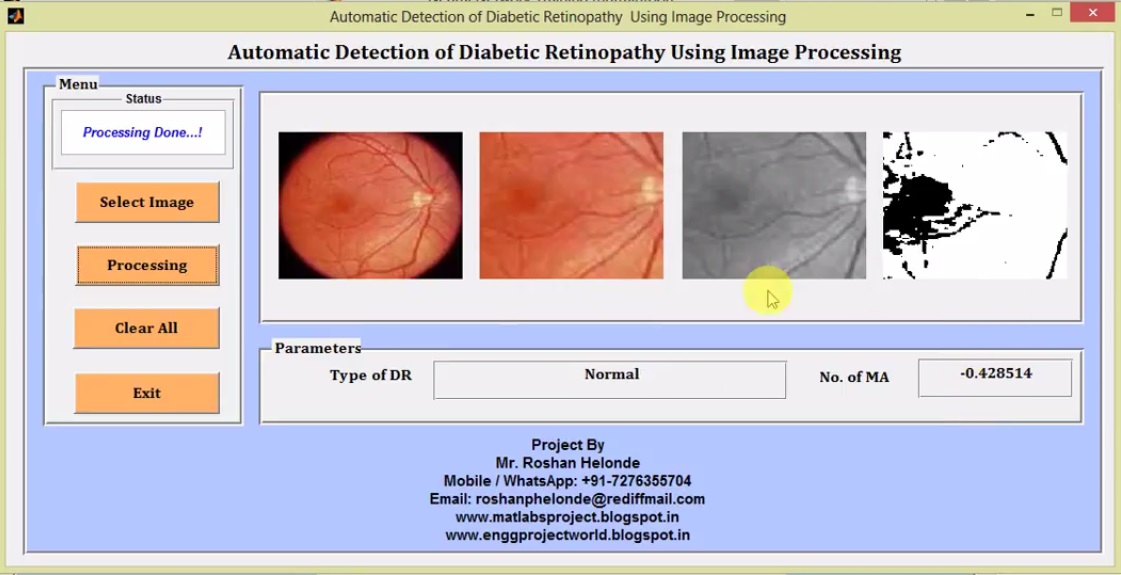 Detection of Diabetic Retinopathy In Fundus Images Using Neural Network