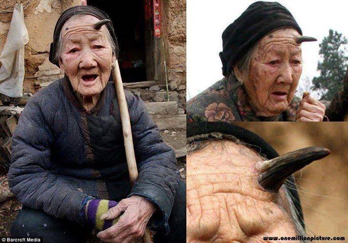 Mindblowing Planet Earth A 101 Year Old Woman Grows Horns And Now 