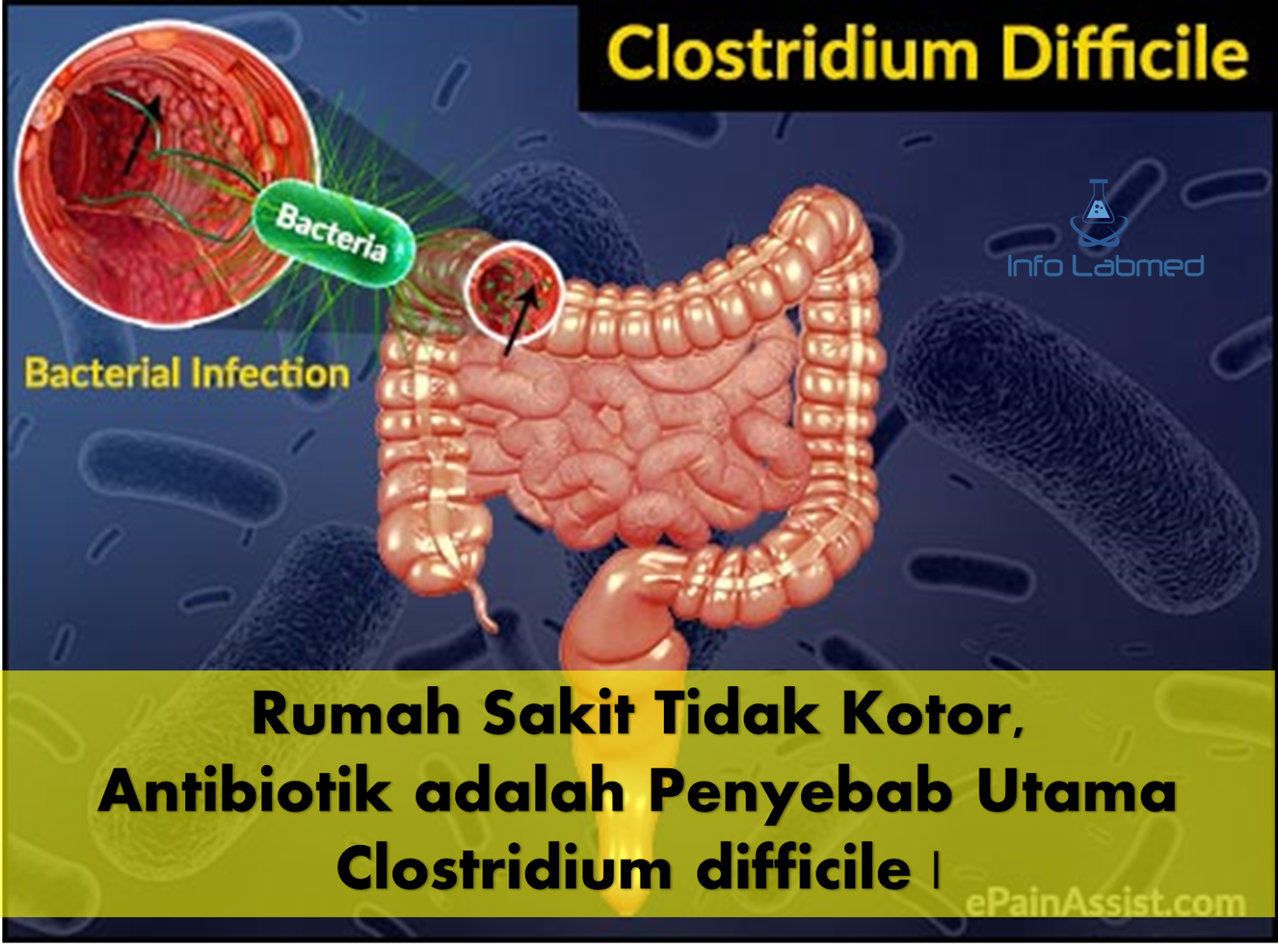 Токсин cl difficile. Clostridium difficile антибиотики. Клостридиоз кишечника.