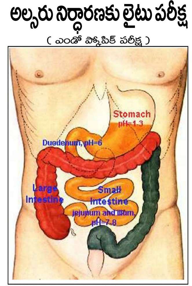 TELUGU WEB WORLD ULCER PROBLEM Gastrointestinal Endoscopy Test