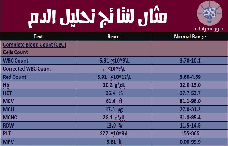 Paradokss المندوبين Imigracija Cbc تحليل الدم Woodcrestgolf Com