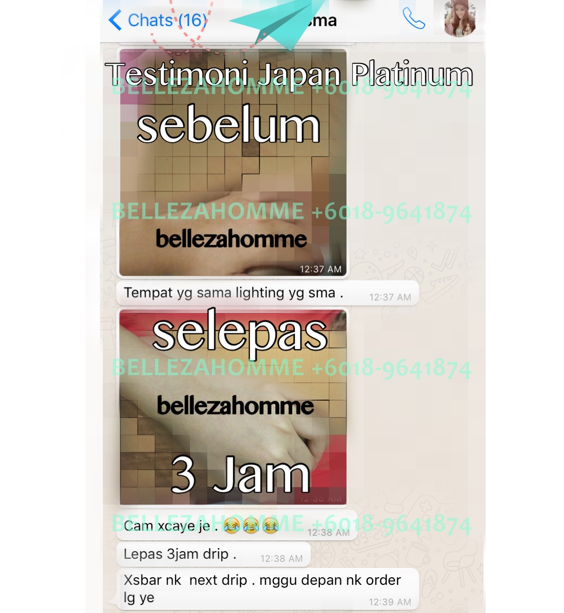 . JAPAN PLATINUM WHITENING INJECTION / GOLDEN WHITE WHITENING INJECTION