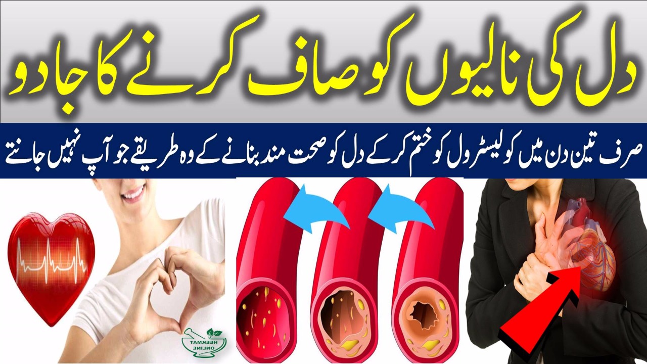 Cholesterol Diet Food Chart In Urdu