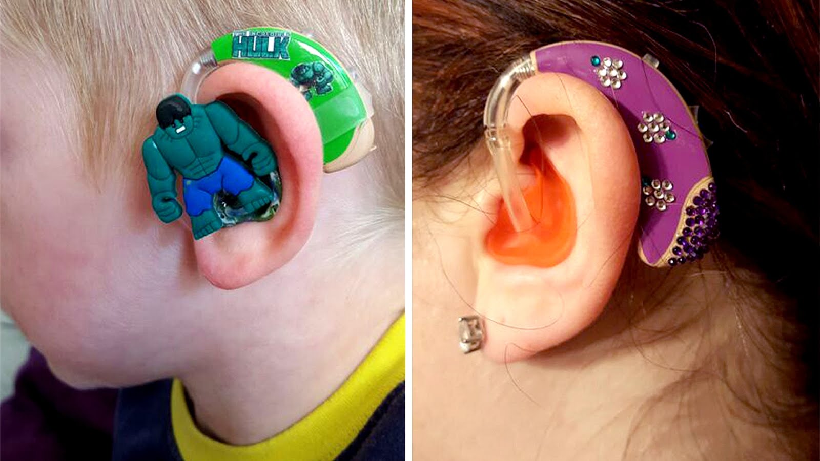 Deaf In One Ear Hearing Aid Hear Choices