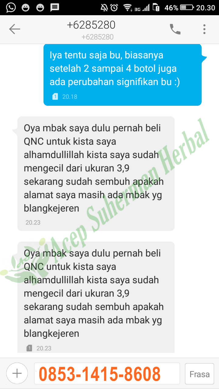 Obat Herbal Atasi Kista Tanpa Harus Operasi