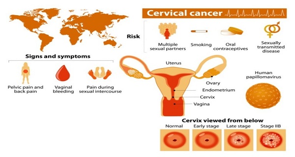A review of risk factors in the development of cervical malignancy