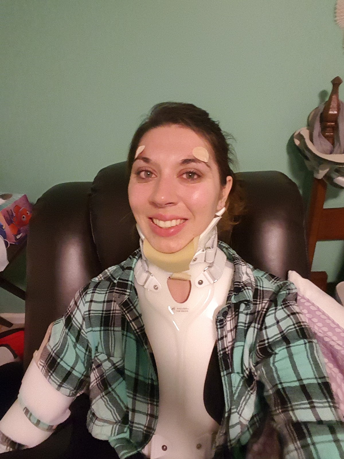 The Halo Diaries Halo Brace Removal December 2016