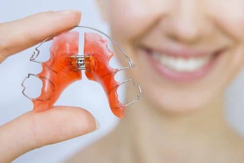 Orthodontie adulte bouche en chantier Mes dents ont Orthodontie adulte bouche en chantier Mes dents ont