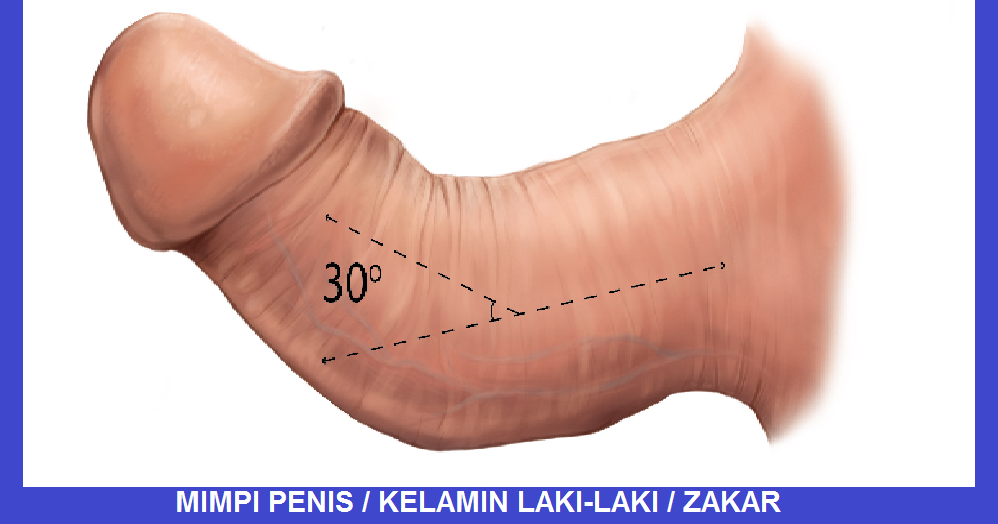 Mimpi Penis Kelamin Laki Laki Zakar Menurut Primbon