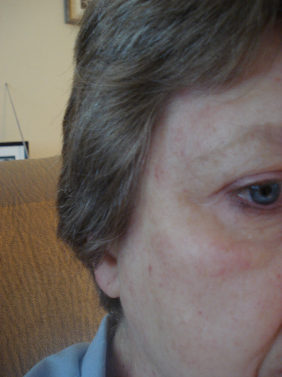 A Wyoming Woman's Thoughts It's Allergy Season