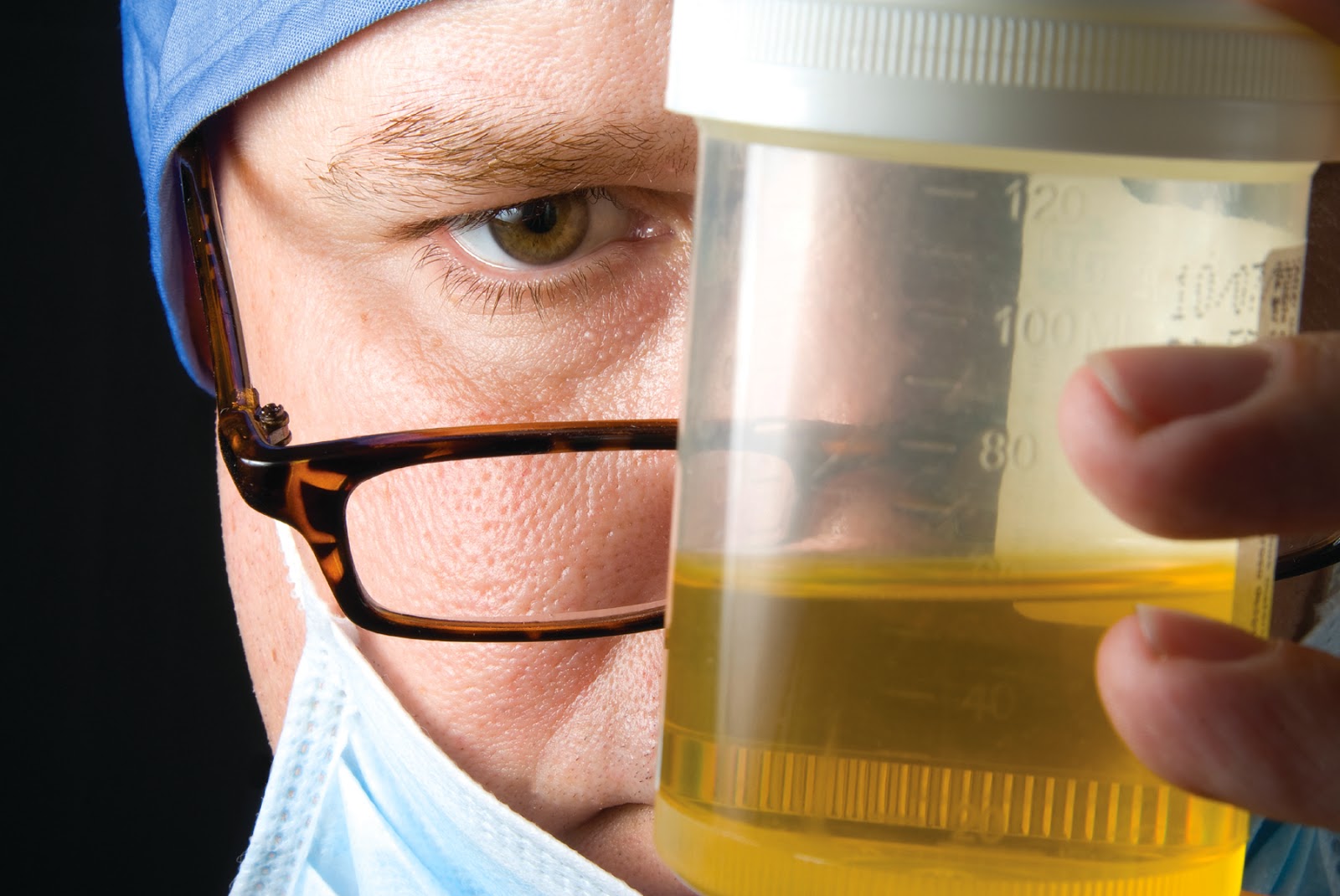 Maple Syrup Urine Disease What Is MSUD Continued Maple Syrup Urine Disease What Is MSUD Continued