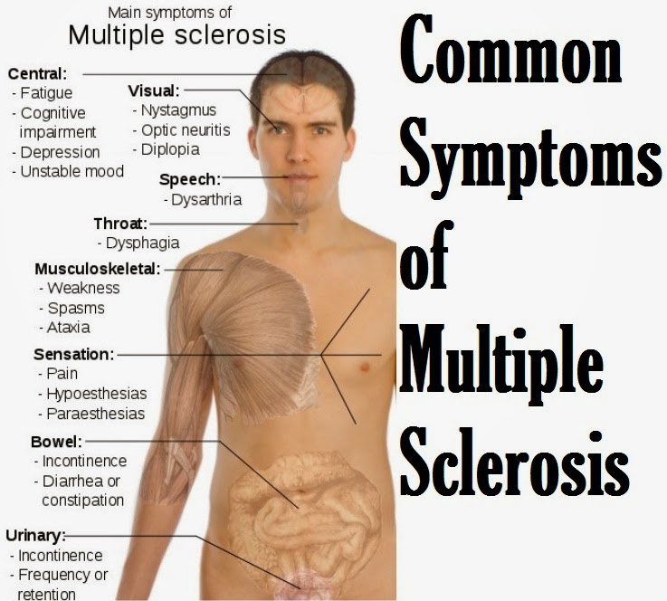 Common Symptoms of Multiple Sclerosis SkinnyZine