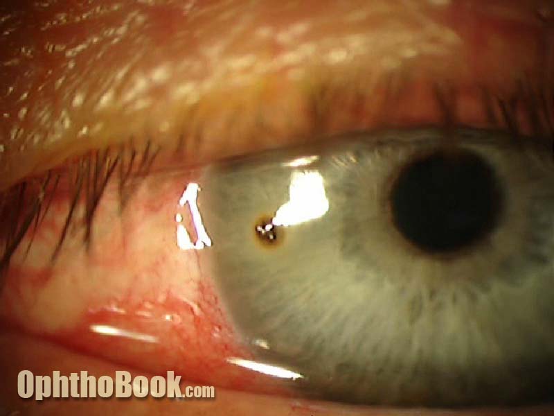 Internal Optimist Medical Student to Junior Doctor Blog