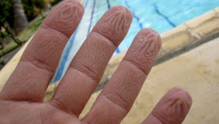Όταν τα δάχτυλά σας ζαρώνουν στο νερό, δεν είναι επειδή «μούλιασαν»...